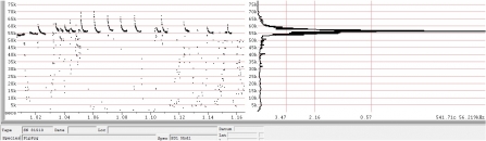 Soprano pipistrelle ZC file from Anabat (analysed in Analook)